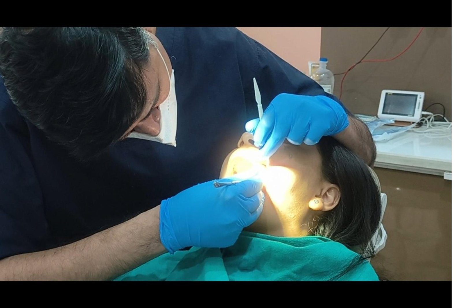 Best Wisdom Tooth Removal by Dr. Aakash Arora at Dental Park Ghaziabad