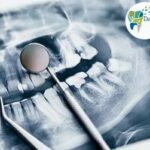 3D Dental Image Displayed on a Screen at Dental Park Ghaziabad