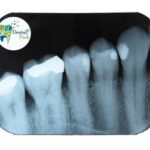 Dental X Ray in Ghaziabad | Dental Park