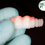 A variety of dentures including complete dentures, removable partial dentures, and flexible dentures displayed at Dental Park.