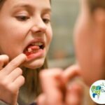 Mobile teeth requiring treatment at Dental Park Ghaziabad