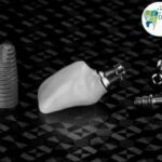 Close-up photograph of a dental implant part at Dental Park, highlighting the best dental implants available for fixed teeth replacement of missing teeth.