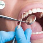 Close-up of a dentist performing teeth reshaping procedure on a patient's teeth