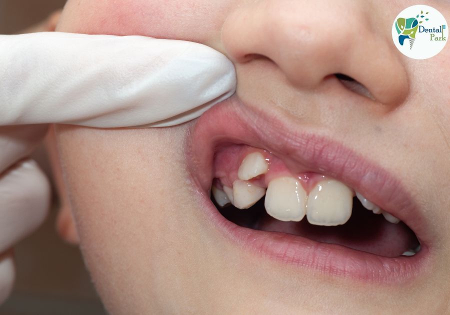 Best Dental Clinic in Ghaziabad | Dental Park orthodontist doctor | dentist near me | dentist in ghaziabad | best dentist | dentist | braces | aligner