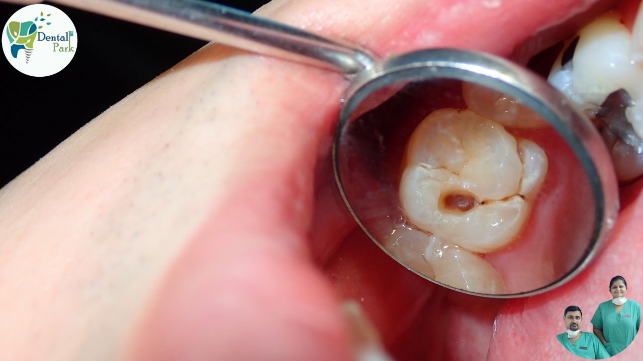 Best Dental Clinic in Ghaziabad | Dental Park Page Not found | Ghaziabad | Delhi | Noida | Dentist | dentist near me | Dental Clinic near me best dentist near me | nearest dental clinic | nearest hospital | dentist nearby | teeth hospital near me