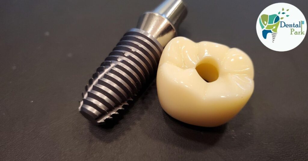 single tooth implant type