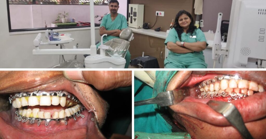 Best Dental Clinic in Ghaziabad | Dental Park pre and post reconstructive jaw surgery | reconstructive Jaw surgery