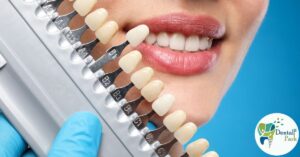 Cosmetic Dentistry