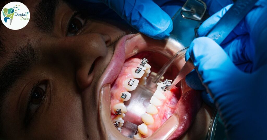Best Dental Clinic in Ghaziabad | Dental Park Dentist in Ramprastha Ghaziabad