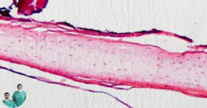 Anorganic Bovine Bone Matrix